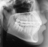 Radiologia Odontológica em Caruaru